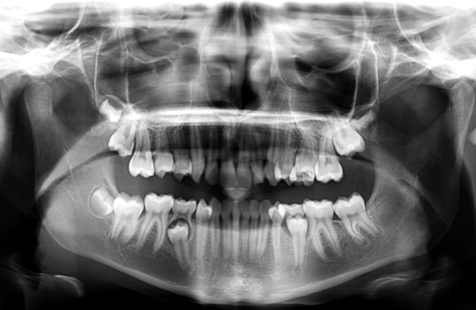 Dental Imaging Radius Imaging